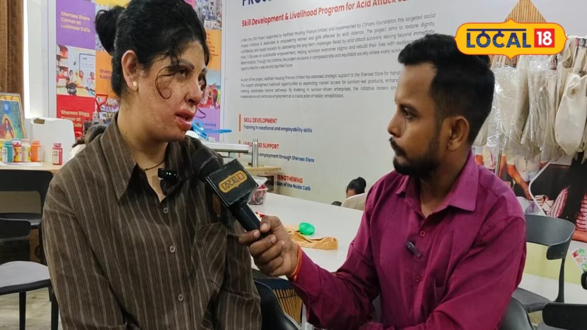 चार साल की उम्र में गैस ब्लास्ट में तबस्सुन का चेहरा झुलसा, नहीं मिला स्कूल में एडमिशन, अब हैंडीक्राफ्ट व होटल इंडस्ट्री की ले रहीं ट्रेनिंग